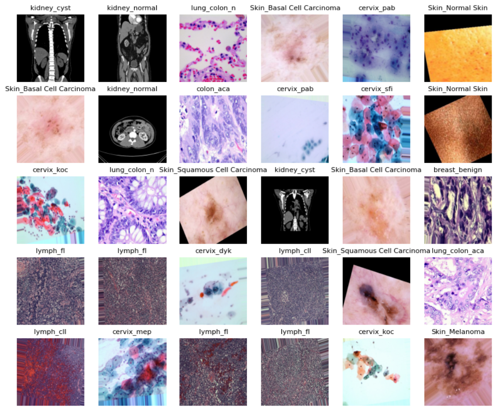 A sample of cancer diagnostic images